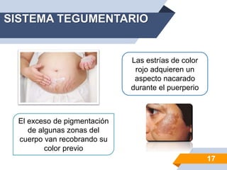 SISTEMA TEGUMENTARIO
El exceso de pigmentación
de algunas zonas del
cuerpo van recobrando su
color previo
Las estrías de color
rojo adquieren un
aspecto nacarado
durante el puerperio
17
 