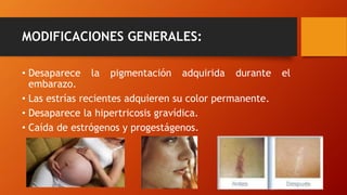 MODIFICACIONES GENERALES:
• Desaparece la pigmentación adquirida durante el
embarazo.
• Las estrías recientes adquieren su color permanente.
• Desaparece la hipertricosis gravídica.
• Caída de estrógenos y progestágenos.
 