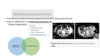 TROMBOFLEBITIS PÉLVICA SÉPTICA
• Formación de un trombo en territorio venoso de la pelvis (vena ovárica) sobreinfectado
• Incidencia 1/2000 partos, tras endometritis postcesárea 1%
“Fiebre Enigmática” Clínica:
• Fiebre en picos
• Escalofríos
• Dolor abdominal
• Mal estado general.
*Diagnóstico de Exclusión otras causas fiebre puerperal.
* TAC
ANTIBIOTICOS
ENDOMETRITIS
ANTOCOAGULACIÓN
 