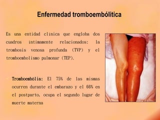 Enfermedad tromboembólitica
Es una entidad clínica que engloba dos
cuadros íntimamente relacionados: la
trombosis venosa profunda (TVP) y el
tromboembolismo pulmonar (TEP).
 Tromboembólia: El 75% de las mismas
ocurren durante el embarazo y el 66% en
el postparto, ocupa el segundo lugar de
muerte materna
 