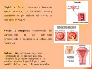  Vaginitis: Es un cuadro menos frecuente
que el anterior, con sus mismas causas y
añadiendo la posibilidad del olvido de
una gasa en vagina
 Cervicitis puerperal: Consecuencia del
agravamiento de una cervicitis
preexistente o secundaria a infecciones
vaginales.
 Endometritis:Infección bacteriana
localizada en el aparato genital,
Invasión de gérmenes patógenos a la
cavidad uterina luego del parto,con
posibilidad de invadir la capa muscular
 