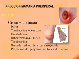 INFECCION MAMARIA PUERPERAL
MASTITIS
 Signos y síntomas:
 Dolor
 Tumefacción edematosa
 Escalofríos
 Hipertermia(39-41ºC)
 Taquicardia
 Marcada red epidérmica enrojecida
 Palpación de ganglios axilares dolorosos
 