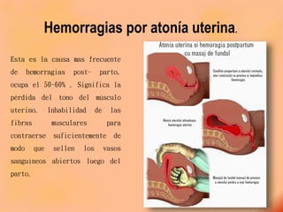 Hemorragias por atonía uterina.
Esta es la causa mas frecuente
de hemorragias post- parto,
ocupa el 50-60% . Significa la
pérdida del tono del músculo
uterino. Inhabilidad de las
fibras musculares para
contraerse suficientemente de
modo que sellen los vasos
sanguíneos abiertos luego del
parto.
 