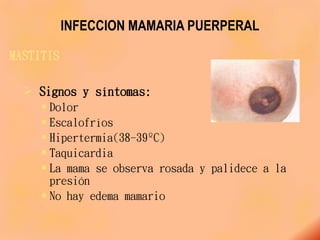 INFECCION MAMARIA PUERPERAL
MASTITIS
 Signos y síntomas:
 Dolor
 Escalofríos
 Hipertermia(38-39ºC)
 Taquicardia
 La mama se observa rosada y palidece a la
presión
 No hay edema mamario
 