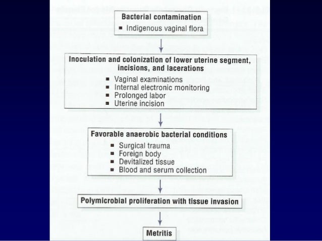 Diagnosis and treatment of ureaplasma in women Diagnosis and treatment of ureaplasma in women