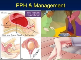 PPH & Management
 