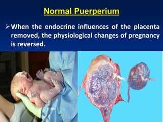 PuerperiumNormal
When the endocrine influences of the placenta
removed, the physiological changes of pregnancy
is reversed.
 
