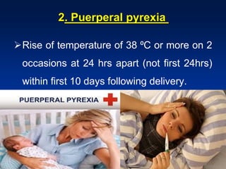. Puerperal pyrexia2
Rise of temperature of 38 ⁰C or more on 2
occasions at 24 hrs apart (not first 24hrs)
within first 10 days following delivery.
 