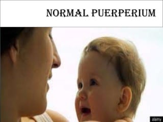 Normal puerperium
 