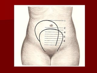 3 - Pós-parto remoto ( além do 45º dia ) Puerpério imediatoCRISE GENITAL; Fenômenos involutivos das estruturas hipertrofiadas ou hiperplasiadas.O (FUNDUS UTERI ) fundo uterino regride, contrações uterinas persistem, provocando algumas cólicas dolorosas, (palpamos o útero a 12cm da sínfise púbica).
