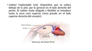 • Catéter implantable (vía). Dispositivo que se coloca
debajo de la piel, por lo general en el lado derecho del
pecho. El catéter (tubo delgado y flexible) se introduce
hasta la vena cava superior (vena grande en el lado
superior derecho del corazón).
 