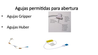 Agujas permitidas para abertura
• Agujas Gripper
• Agujas Huber
 