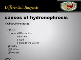 causes of hydronephrosis
A)Obstructive causes
1)PUJO
2)Ureteral Obstruction
a-Lumen
b-wall
c-outside the ureter
3)Bladder
4)Urethra
5)Prostate
B)VUR
 