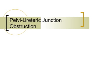 Pelvi-Ureteric Junction
Obstruction
 