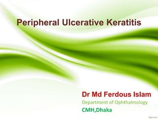 Peripheral Ulcerative Keratitis
Dr Md Ferdous Islam
Department of Ophthalmology
CMH,Dhaka
 