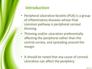 Introduction
• Peripheral Ulcerative Keratits (PUK) is a group
of inflammatory diseases whose final
common pathway is peripheral corneal
thinning
• Thinning and/or ulceration preferentially
affecting the peripheral rather than the
central cornea, and spreading around the
margin
• It should be noted that any cause of corneal
ulceration can affect the periphery
 