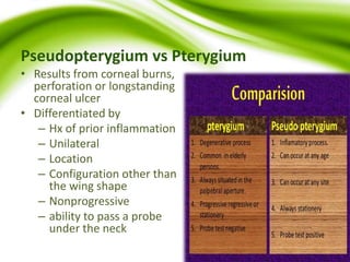 Pseudopterygium vs Pterygium
• Results from corneal burns,
perforation or longstanding
corneal ulcer
• Differentiated by
– Hx of prior inflammation
– Unilateral
– Location
– Configuration other than
the wing shape
– Nonprogressive
– ability to pass a probe
under the neck
 