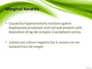 Marginal Keratitis
• Caused by hypersensitivity reaction against
Staphylococcal exotoxin and cell wall proteins with
deposition of Ag-Ab complex in peripheral cornea
• Leisons are culture negative but S. aureus can be
isolated from lid margin
 