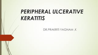 PERIPHERAL ULCERATIVE
KERATITIS
DR.PRAKRITI YAGNAM .K
 