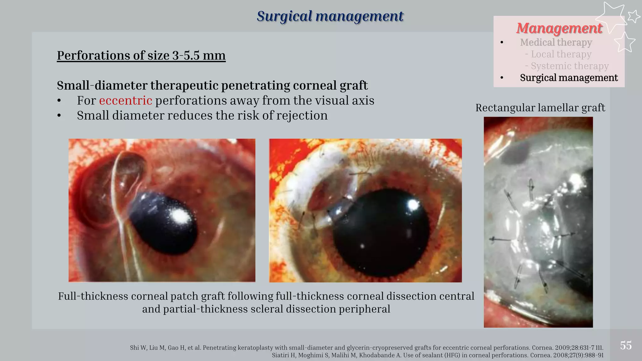 Management
• Medical therapy
- Local therapy
- Systemic therapy
• Surgical management
55
Surgical management
Shi W, Liu M, Gao H, et al. Penetrating keratoplasty with small-diameter and glycerin-cryopreserved grafts for eccentric corneal perforations. Cornea. 2009;28:631-7 111.
Siatiri H, Moghimi S, Malihi M, Khodabande A. Use of sealant (HFG) in corneal perforations. Cornea. 2008;27(9):988-91
Rectangular lamellar graft
Perforations of size 3-5.5 mm
Small-diameter therapeutic penetrating corneal graft
• For eccentric perforations away from the visual axis
• Small diameter reduces the risk of rejection
Full-thickness corneal patch graft following full-thickness corneal dissection central
and partial-thickness scleral dissection peripheral
 