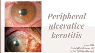 Peripheral
ulcerative
keratitis
14 June 2022
Parinda Phinitkitanan, MD.
Advisor Aj.Chakree Hirunpat
 