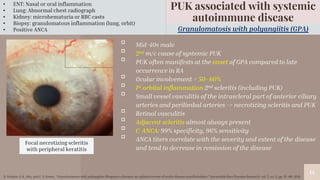 “
14
14
Granulomatosis with polyangiitis (GPA)
PUK associated with systemic
autoimmune disease
▫ Mid-40s male
▫ 2nd m/c cause of systemic PUK
▫ PUK often manifests at the onset of GPA compared to late
occurrence in RA
▫ Ocular involvement = 50–60%
▫ 1st orbital inflammation 2nd scleritis (including PUK)
▫ Small vessel vasculitis of the intrascleral part of anterior ciliary
arteries and perilimbal arteries -> necrotizing scleritis and PUK
▫ Retinal vasculitis
▫ Adjacent scleritis almost always present
▫ C-ANCA: 99% specificity, 96% sensitivity
▫ ANCA titers correlate with the severity and extent of the disease
and tend to decrease in remission of the disease
• ENT: Nasal or oral inflammation
• Lung: Abnormal chest radiograph
• Kidney: microhematuria or RBC casts
• Biopsy: granulomatous inflammation (lung, orbit)
• Positive ANCA
Focal necrotizing scleritis
with peripheral keratitis
B. Kubaisi, S. K. Abu, and C. S. Foster, “Granulomatosis with polyangiitis (Wegener’s disease): an updated review of ocular disease manifestations,” Intractable Rare Diseases Research, vol. 5, no. 2, pp. 61–69, 2016.
 