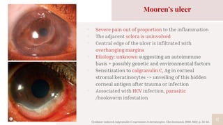 17
Mooren’s ulcer
▫ Severe pain out of proportion to the inflammation
▫ The adjacent sclera is uninvolved
▫ Central edge of the ulcer is infiltrated with
overhanging margins
▫ Etiology: unknown suggesting an autoimmune
basis + possibly genetic and environmental factors
▫ Sensitization to calgranulin C, Ag in corneal
stromal keratinocytes -> unveiling of this hidden
corneal antigen after trauma or infection
▫ Associated with HCV infection, parasitic
/hookworm infestation
Cytokine-induced calgranulin C expression in keratocytes. Clin Immunol, 1999. 91(1): p. 34-40.
 