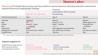 19
Typical or benign (m/c)
Atypical
young black African males
Parasitemia
Watson in 1997 divided Mooren ulcer into three distinct varieties based on clinical presentation and anterior
segment fluorescein angiographic findings
Superficial vascular plexus
Deep vascular plexus
Vascularization of ulcer
Normal
Intense deep leakage
Deep vessels
Normal
Vasodilation
Deep vessels
Mooren’s ulcer
Anterior segment FA
Obliterate
Intense deep leakage
superficial and deep vessels
iritis, intense AC inflammation, secondary infections, glaucoma, cataract, and corneal perforation in ∼35–40% of cases
Watson, P.G., Management of Mooren's ulceration. Eye (Lond), 1997. 11 ( Pt 3): p. 349-56.
> 60 yr 14-40 yr
 