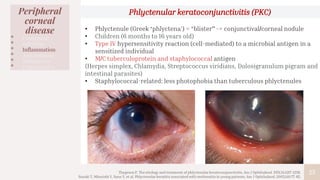 25
Peripheral
corneal
disease
• Congenital
• Infection
• Inflammation
• Autoimmune
• Malignancy
• Degenerative
Phlyctenular keratoconjunctivitis (PKC)
• Phlyctenule (Greek ‘phlyctena’) = “blister” -> conjunctival/corneal nodule
• Children (6 months to 16 years old)
• Type IV hypersensitivity reaction (cell-mediated) to a microbial antigen in a
sensitized individual
• M/C tuberculoprotein and staphylococcal antigen
(Herpes simplex, Chlamydia, Streptococcus viridians, Dolosigranulum pigram and
intestinal parasites)
• Staphylococcal-related: less photophobia than tuberculous phlyctenules
Thygeson P. The etiology and treatment of phlyctenular keratoconjunctivitis. Am J Ophthalmol. 1951;34:1217-1236.
Suzuki T, Mitsuishi Y, Sano Y, et al. Phlyctenular keratitis associated with meibomitis in young patients. Am J Ophthalmol. 2005;140:77-82.
 