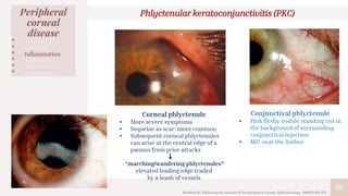 26
Peripheral
corneal
disease
• Congenital
• Infection
• Inflammation
• Autoimmune
• Malignancy
• Degenerative
Phlyctenular keratoconjunctivitis (PKC)
Corneal phlyctenule
• More severe symptoms
• Sequelae as scar: more common
• Subsequent corneal phlyctenules
can arise at the central edge of a
pannus from prior attacks
“marching/wandering phlyctenules”
elevated leading edge trailed
by a leash of vessels
Conjunctival phlyctenule
• Pink fleshy nodule standing out in
the background of surrounding
conjunctival injection
• M/C near the limbus
Mondino BJ. Inflammatory diseases of the peripheral cornea. Ophthalmology. 1988;95:463-472.
 