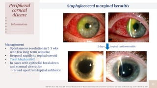 31
Peripheral
corneal
disease
• Congenital
• Infection
• Inflammation
• Autoimmune
• Malignancy
• Degenerative
Staphylococcal marginal keratitis
Stiff AH, Ricca AM, Goins KM. Corneal Marginal Ulcer: Marginal keratitis with ulceration in a 45 year-old male. EyeRounds.org. posted March 14, 2017
Management
• Spontaneous resolution in 2-3 wks
with few long-term sequelae
• Respond rapidly to topical steroid
• Treat blepharitis!!
• In cases with epithelial breakdown
and stromal ulceration
-> broad-spectrum topical antibiotic
2 days topical corticosteroids
 