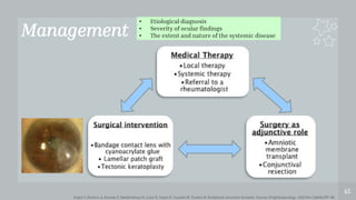 Management
45
• Etiological diagnosis
• Severity of ocular findings
• The extent and nature of the systemic disease
Gupta Y, Kishore A, Kumari P, Balakrishnan N, Lomi N, Gupta N, Vanathi M, Tandon R. Peripheral ulcerative keratitis. Survey of Ophthalmology. 2021 Nov 1;66(6):977-98.
 