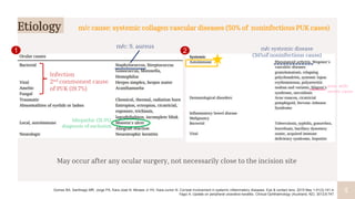 5
5
Idiopathic (31.5%)
diagnosis of exclusion
m/c cause: systemic collagen vascular diseases (50% of noninfectious PUK cases)
m/c systemic disease
(34%of noninfectious cause)
m/c: S. aureus
May occur after any ocular surgery, not necessarily close to the incision site
asso. with
severe cases
Infection
2nd commonest cause
of PUK (19.7%)
Etiology
1 2
Gomes BA, Santhiago MR, Jorge PA, Kara-José N, Moraes Jr HV, Kara-Junior N. Corneal involvement in systemic inflammatory diseases. Eye & contact lens. 2015 May 1;41(3):141-4.
Yagci A. Update on peripheral ulcerative keratitis. Clinical Ophthalmology (Auckland, NZ). 2012;6:747.
 