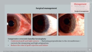 Management
• Medical therapy
- Local therapy
- Systemic therapy
• Surgical management
58
Surgical management
Compressive crescentic lamellar keratoplasty
• Undersized graft and tight sutures -> flattening perpendicular to the circumference +
corrects the steepening and high astigmatism
• Reduce the risks of graft rejection and failure
Gao H, Wang X, Echegaray JJ, et al. Partial lamellar keratoplasty for peripheral corneal disease using a graft from the glycerin-preserved corneoscleral rim. Graefes Arch Clin Exp Ophthalmol 2014;252:963–8.
 