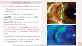 Clinical Features
▫ Mostly unilateral (If bilateral, often asymmetrical)
▫ Initial symptoms: injection, pain, tearing, and
photophobia
▫ Pain out of proportion -> Mooren’s ulcer
▫ Acute PUK -> decreased vision vary from mild to
severe due to inflammation
▫ Chronic PUK -> decreased vision due to corneal
astigmatism and corneal opacity
▫ The most important sign: peripheral crescentic
ulceration, an epithelial defect, corneal thinning,
and infiltration at the limbus with overhanging
edges
▫ Progress circumferentially and then centripetally
▫ Initially involves the superficial 1/3 of the cornea
-> later progress to corneal perforation
8
Sharma N, Sinha G, Shekhar H, et al. Demographic profile, clinical features and outcome of peripheral ulcerative keratitis: a prospective study. Br J Ophthalmol. 2015;99(11):1503–8.
 