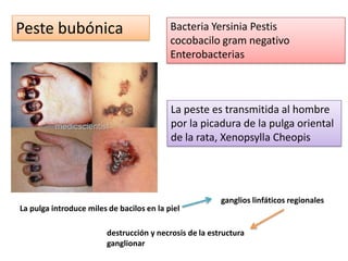 Peste bubónica                             Bacteria Yersinia Pestis
                                           cocobacilo gram negativo
                                           Enterobacterias



                                           La peste es transmitida al hombre
                                           por la picadura de la pulga oriental
                                           de la rata, Xenopsylla Cheopis




                                                         ganglios linfáticos regionales
La pulga introduce miles de bacilos en la piel

                         destrucción y necrosis de la estructura
                         ganglionar
 