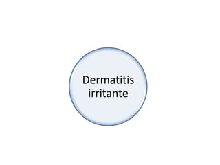 Dermatitis
 irritante
 