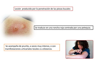 Lesión producida por la penetración de las piezas bucales




                              Se traduce en una roncha roja centrada por una petequia.




Se acompaña de prurito, a veces muy intenso, o con
manifestaciones urticariales locales o a distancia.
 