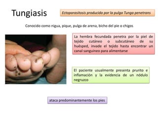 Tungiasis                Ectoparasitosis producida por la pulga Tunga penetrans


   Conocido como nigua, pique, pulga de arena, bicho del pie o chigos

                                La hembra fecundada penetra por la piel de
                                tejido cutáneo o subcutáneo de su
                                huésped, invade el tejido hasta encontrar un
                                canal sanguineo para alimentarse



                                El paciente usualmente presenta prurito e
                                inflamación y la evidencia de un nódulo
                                negruzco




                 ataca predominantemente los pies
 