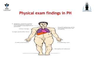 Physical exam findings in PH
 