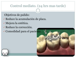 Control mediato. (24 hrs mas tarde)
Objetivos de pulido:
 Reduce la acumulación de placa.
 Mejora la estética.
 Reduce la corrección.
 Comodidad para el paciente.
 