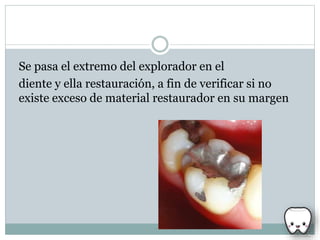 Se pasa el extremo del explorador en el
diente y ella restauración, a fin de verificar si no
existe exceso de material restaurador en su margen
 