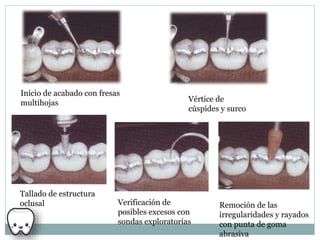 Inicio de acabado con fresas
multihojas Vértice de
cúspides y surco
Tallado de estructura
oclusal Verificación de
posibles excesos con
sondas exploratorias
Remoción de las
irregularidades y rayados
con punta de goma
abrasiva
 