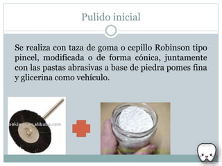 Pulido inicial
Se realiza con taza de goma o cepillo Robinson tipo
pincel, modificada o de forma cónica, juntamente
con las pastas abrasivas a base de piedra pomes fina
y glicerina como vehículo.
 