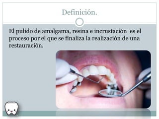 Definición.
El pulido de amalgama, resina e incrustación es el
proceso por el que se finaliza la realización de una
restauración.
 