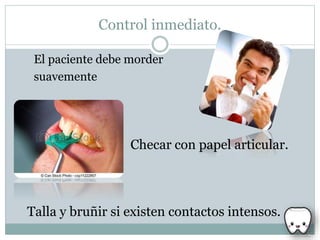 Control inmediato.
El paciente debe morder
suavemente
Checar con papel articular.
Talla y bruñir si existen contactos intensos.
 
