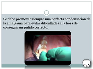 Se debe promover siempre una perfecta condensación de
la amalgama para evitar dificultades a la hora de
conseguir un pulido correcto.
 