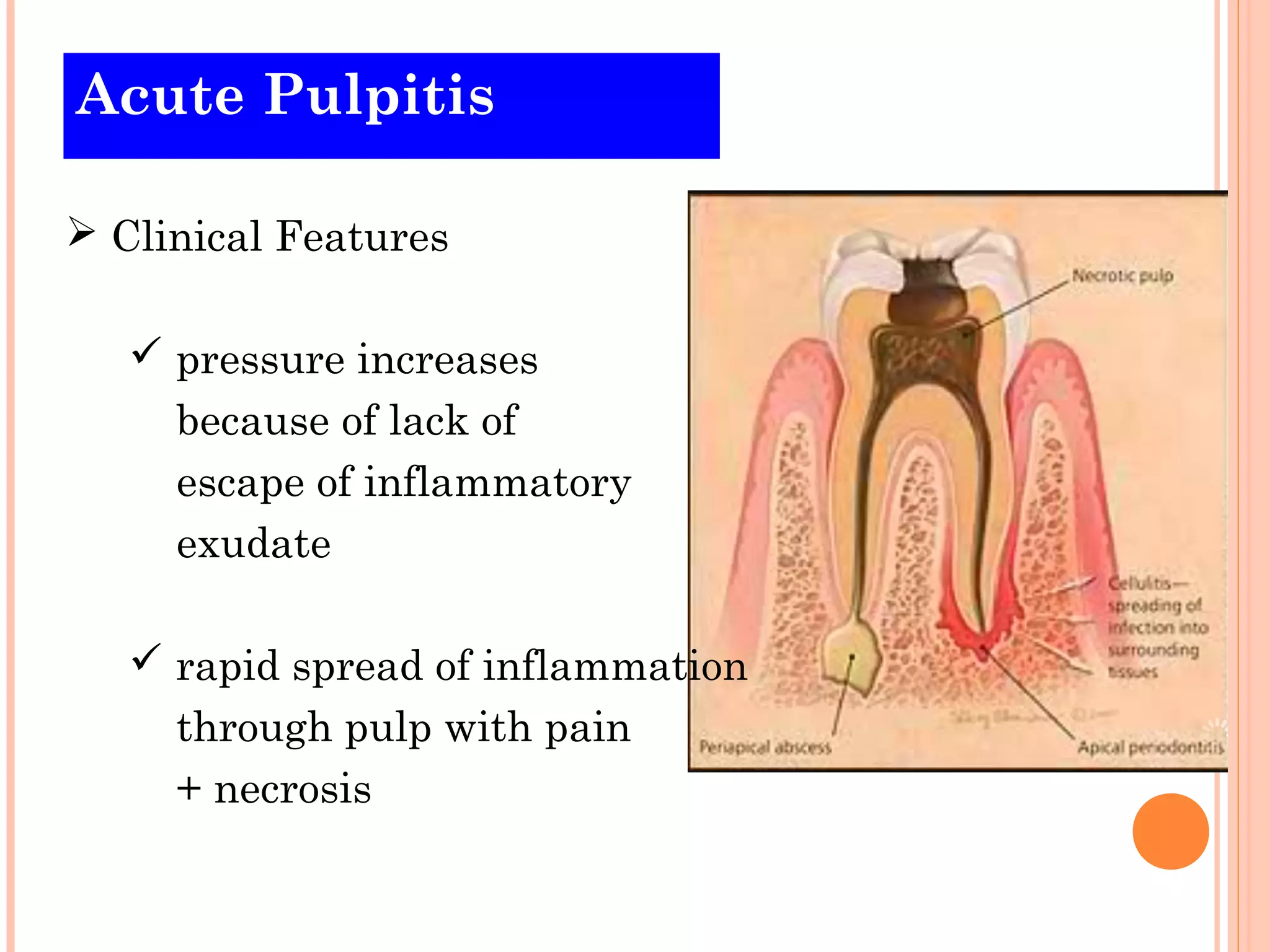 Pulpulitis Pulipitis | PPT