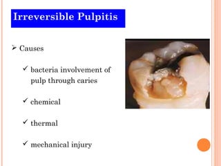 Irreversible Pulpitis


 Causes

   bacteria involvement of
    pulp through caries

   chemical

   thermal

   mechanical injury
 