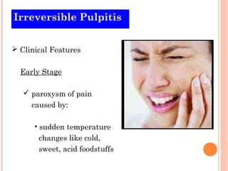 Irreversible Pulpitis


 Clinical Features


  Early Stage

    paroxysm of pain
     caused by:

      • sudden temperature
       changes like cold,
       sweet, acid foodstuffs
 